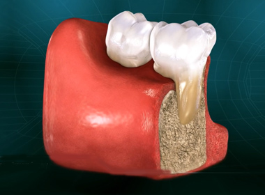 OSSEOUS SURGERY