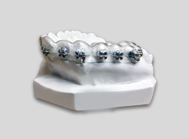 ADULT ORTHODONTICS