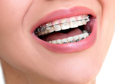 orthodontic